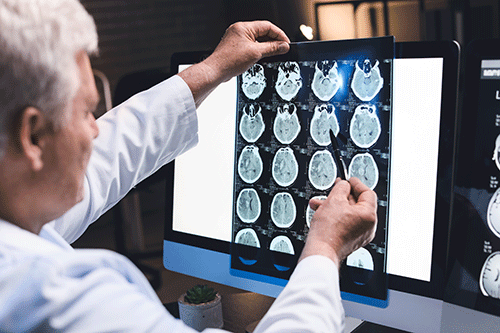 a neurologist looks at imaging